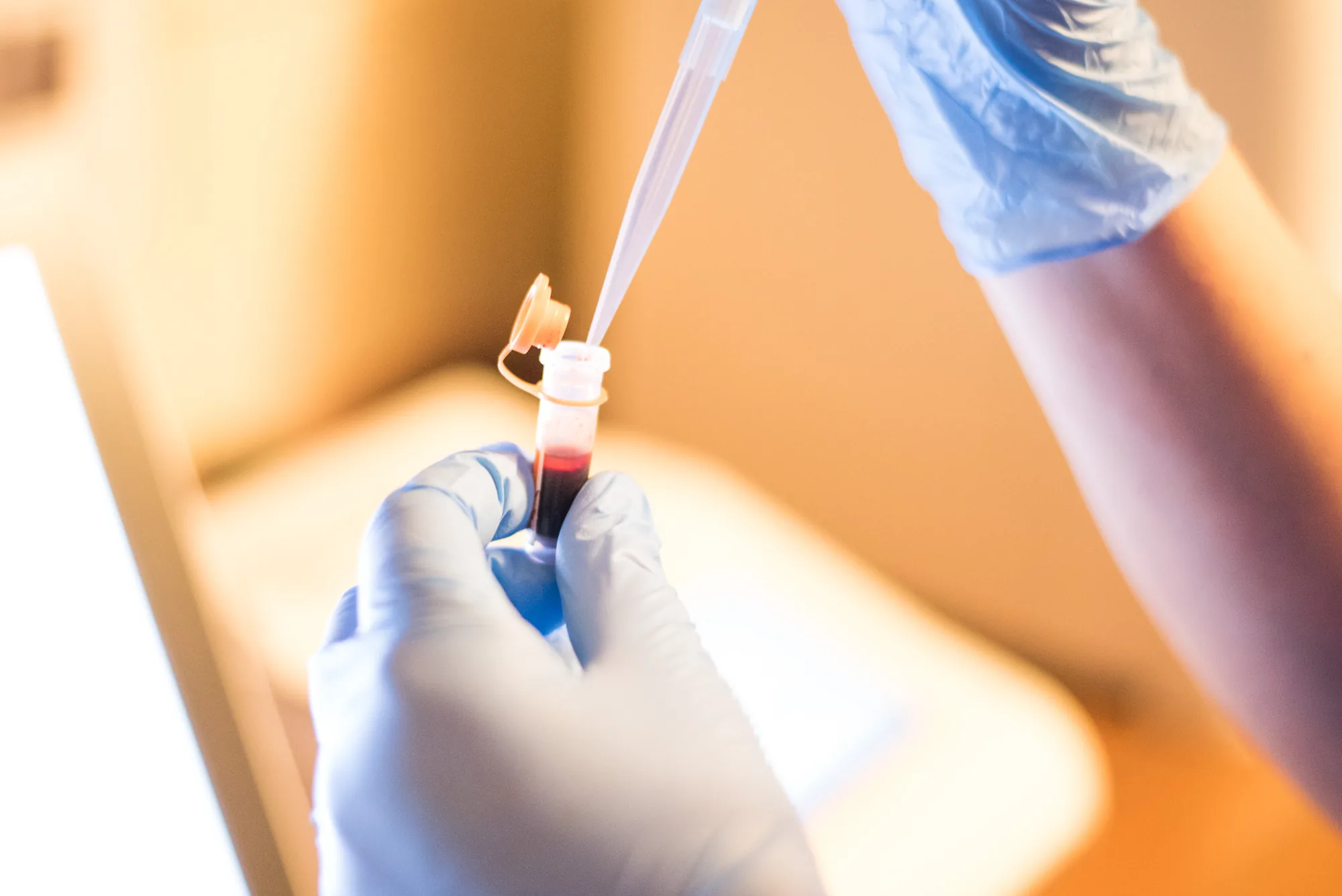 Pipetowanie próbki krwi w laboratorium Kliniki VETKA